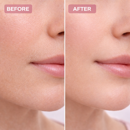 Facial Hair Trimmer for Women | Painless Peach Fuzz Remover