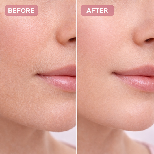 Facial Hair Trimmer for Women | Painless Peach Fuzz Remover