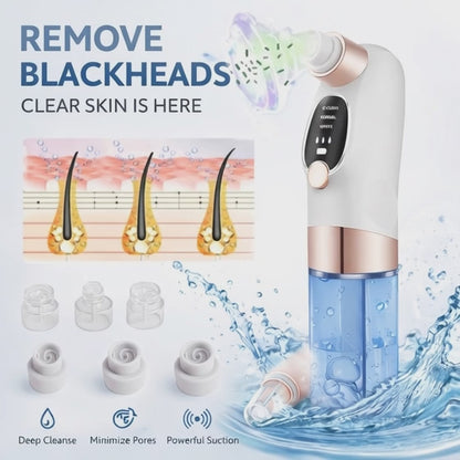 Electric Blackhead Remover for Deep Pore Cleansing & Clear Skin